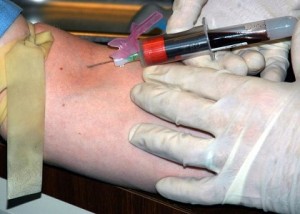 New HIV Vaccine